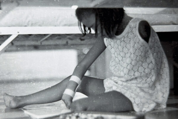 Child amputee in hospital during the Vietnam War