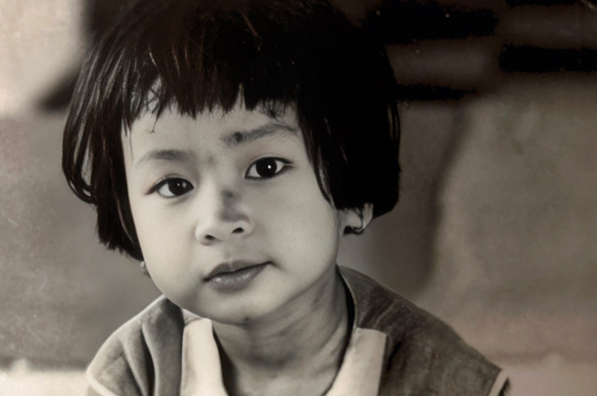 Child casualty of Vietnam war named Mai in Quy Nhon, Vietnam 1968/9