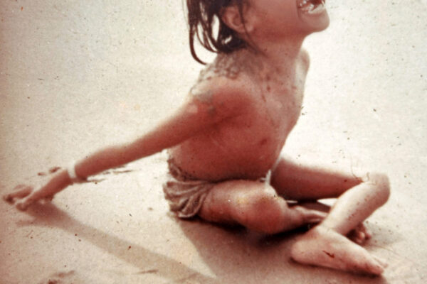 Paralysed child Vietnam war Qui Nhon