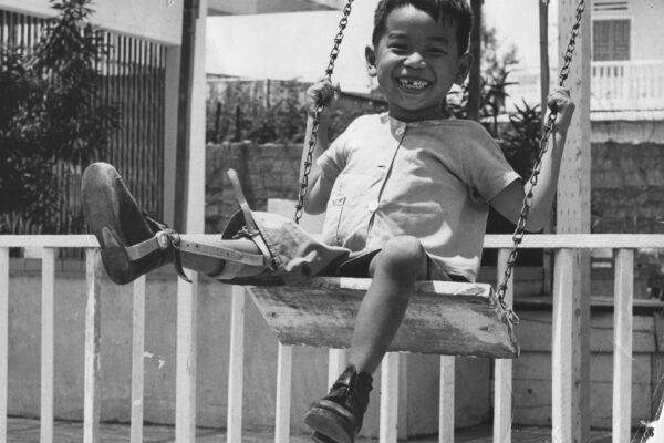 Injured child with leg brace during the Vietnam war